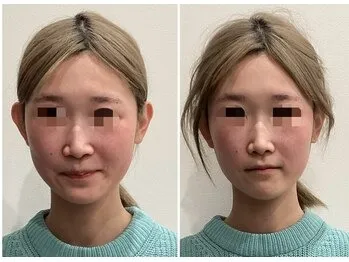 施術事例