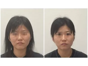 施工事例