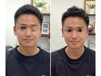 施術事例