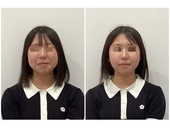 施術事例