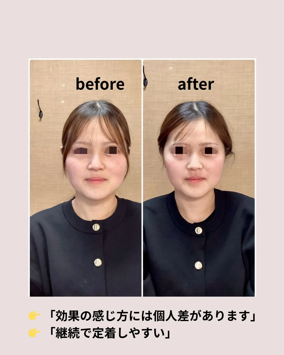 最近、顔が下がってきた気がする