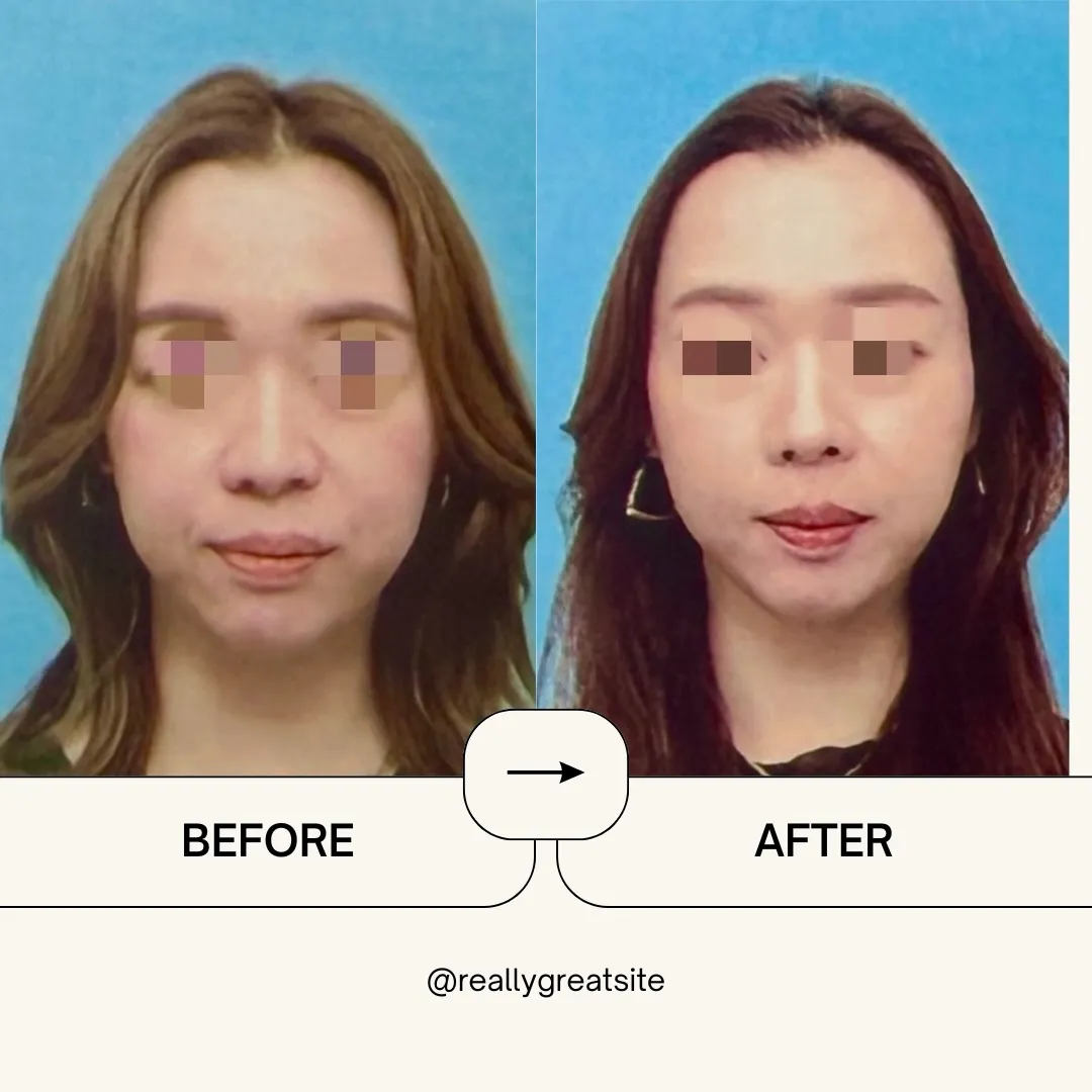 「5年前の写真と比べたら、こんなに違うんです！」