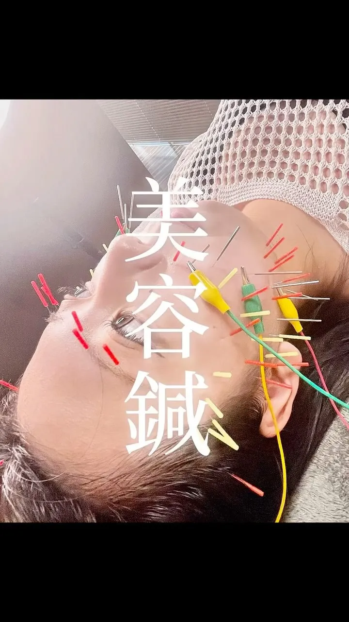 美容鍼のお客様