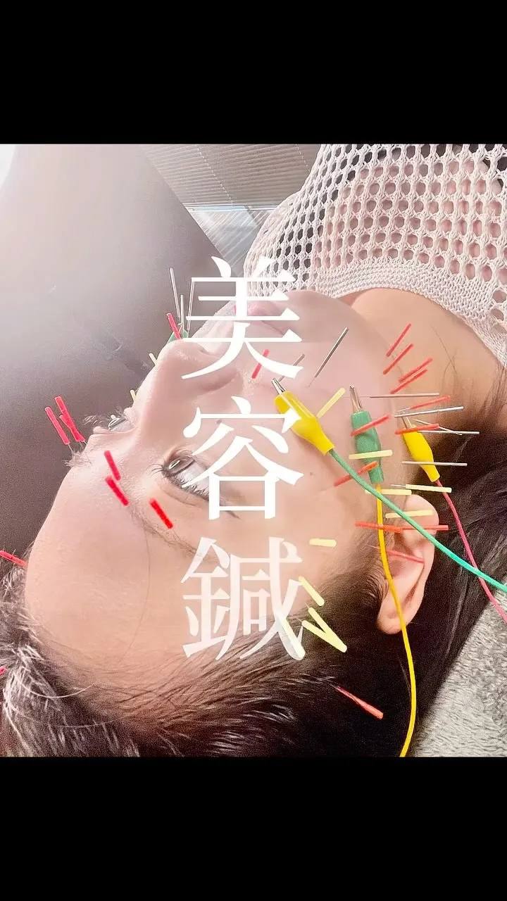 美容鍼のお客様